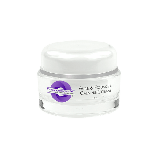 Acne & Rosacea Calming Cream